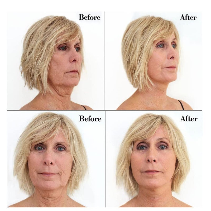 Bring It Up Instant Neck Lift Tape 30 Day Supply, Transparent Neck Lifting Anti Wrinkle Stickers - Tones Sagging Necklines Instantly - Made in USA - Image 5